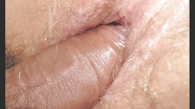 角質の医師からの二つのお風呂看護師